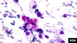 Produce criptococosis, Medline Plus la define como una afección pulmonar, cuyos síntomas son: dolor de cabeza, tos y confusión; pueden presentarse erupciones en la piel, “si se inhala, infecta los pulmones. La infección puede desaparecer por sí sola, permanecer sólo en los pulmones o propagarse por todo el cuerpo”, afecta especialmente a personas inmunodeficientes. Se encuentra en la tierra y está disperso en regiones el oeste de Estados Unidos, Canadá, África, y Australia y otras regiones del mundo.