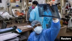 Rohan Aggarwal, de 26 años, médico residente que trata a pacientes que padecen la enfermedad del coronavirus (COVID-19), observa la radiografía de un paciente en el Hospital Holy Family en Nueva Delhi, India, el 1 de mayo de 2021.