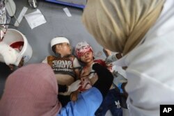FILE - Palestinian children wounded in the Israeli bombardment of the Gaza Strip are treated in al-Aqsa Hospital in Deir al Balah, June 9, 2024.