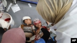 ARCHIVO - Niños palestinos heridos en el bombardeo israelí de la Franja de Gaza son atendidos en el hospital al-Aqsa en Deir al Balah, el 9 de junio de 2024.