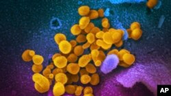FILE - This undated, colorized electron microscope image made available by the U.S. National Institutes of Health in February 2020 shows the Novel Coronavirus SARS-CoV-2, indicated in yellow, emerging from the surface of cells, indicated in blue/pink, cultured in a laboratory.
