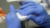 Prueban en monos dos vacunas contra el zika 