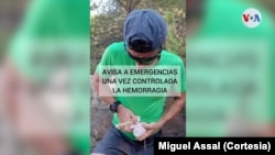 Los expertos recomiendan practicar los primeros auxilios, pero inmediatamente avisar a los equipos de emergencias, que son los que tienen el conocimiento y la experiencia. Foto: Cortesía/Miguel Assal.