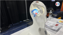 ARCHIVO - Este implante cerebral que retrasa el progreso de la enfermedad de Parkinson fue presentado en la Feria CES 2023. 