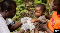 FILE - A child affected by monkeypox, sits on his father's legs while receiving treatment at a center of Doctors Without Borders, in Zomea Kaka, Lobaya region, in the Central African Republic, Oct. 18, 2018.