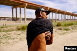 El migrante venezolano Eli Segura muestra una herida de bala de goma que supuestamente recibió cuando agentes fronterizos de EEUU dispararon contra una protesta en Ciudad Juárez, México, el 31 de octubre de 2022.