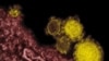 FILE - Rocky Mountain Laboratories shows novel coronavirus particles, also known as the MERS virus, colorized in yellow. 