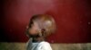 Waka, aged 2, a severely malnourished child sits on the floor at Bangui&#39;s pediatric center in Bangui, Central African Republic, Tuesday, Dec. 17, 2013. According to UNICEF&#39;s doctor Celestin Traore, even though malnutrition is high in the country, the prob