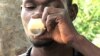 Karamba Kebe is one of 55 recovering drug addicts and alcoholics living at Desavio Jovem, the only drug treatment center in Guinea Bissau