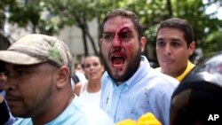 Archivo. El diputado opositor Juan Requesens (centro) es retirado por su colega José Manuel Olivares (derecha) después de ser herido por partidarios del gobierno, durante protestas en la oficina del defensor del pueblo en Caracas, Venezuela, el 3 de abril de 2017. 