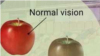 color blindness 