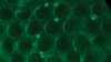 New Test Aims to Make AIDS Diagnosis Easier