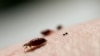 Students, Beware: That Free Curbside Futon Might Carry Critters 