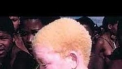 Albinos continuam com medo, mas número de ataques caiu em Nampula