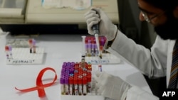 Seorang petugas mengambil sampel darah di laboratorium di dekat simbol peringatan Hari Aids Sedunia. (Foto: dok). Mikhy K. Farrera Brochez. warga AS dituduh sebagai pelaku bocornya informasi rahasia terkait 14.200 pasien yang didiagnosis positif HIV di Singapura, Senin (28/1).