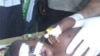 Growing Numbers of Young Children Wounded, Killed in Somalia