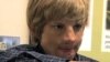 Young Romanian Burn Victim Gets Help in California