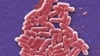 This 2006 colorized scanning electron micrograph image made available by the U.S. Centers for Disease Control and Prevention shows the O157:H7 strain of the E. coli bacteria.