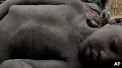A four-year-old South Sudanese boy who collapsed from hunger lies on the ground at a feeding center run by Medecins Sans Frontieres in 2005. Eight years later, malnutrition is again stalking children in Northern Bahr el Ghazal state. (AP)