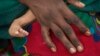 Stunted growth is a result of malnutrition in Chad's Sahel (above) and all of Central Africa. But 40 percent of those stunted children live in Cameroon.