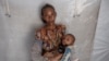 Tigrinyan refugee 38-year-old Rega Tsfay, malnourished mother of her 3-moth-old son Itbarak, stands for a photograph inside a tent, in Umm Rakouba refugee camp in Qadarif, eastern Sudan, Dec. 10, 2020. 