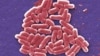 Study Finds that Speeding up Sepsis Care Can Save Lives