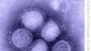Environmentalist: New Thinking Needed on New Diseases