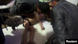 FILE - A child is treated in a hospital in Douma, eastern Ghouta, near Damascus, Syria, after a suspected chemical weapons attack April, 7, 2018. (White Helmets handout via Reuters) 
