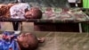 Why Indonesia’s Children Are Not Growing