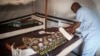 In this Aug. 28, 2014, photo, Aminatou Bello a 24-year-old Muslim, who was attacked by an Anti-Balaka, lies on a bed in Boda, Central African Republic. More than 5,000 people have died in sectarian violence in the Central African Republic since December, 