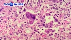 Manchetes Americanas 21 Maio 2019: Casos de sarampo aumentam nos EUA