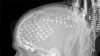 16x9 Image