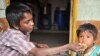 Indian PM: Malnutrition a Matter of 'National Shame'