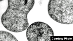 Pyrococcus furiosus (Henry Aldrich, ifas.ufl.edu)