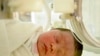 Steroids Affect Brain Development in Premature Babies