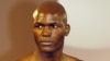 Study Links Early Baldness to Prostate Cancer in African Americans 