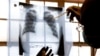 FILE - A doctor examines chest X-rays at a tuberculosis clinic in Gugulethu, Cape Town, South Africa, Jan. 17, 2014. 