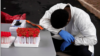 Coronavirus Na Sake Yaduwa a Amurka Da Turai 
