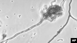 Foto yang dirilis oleh Pusat Pemberantasan Penyakit di Amerika (CDC) menunjukkan jamur yang mencemari suntikan obat metil-prednisolon asetat.