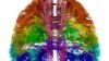 Scientists Map Human, Mouse Brains