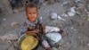 UN Gives Record-setting Emergency Aid Funds to Yemen 