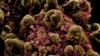 Informe preliminar de OMS no logra identificar el origen de la pandemia