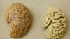 New Blood Test Could Detect Early Stages of Alzheimer’s 
