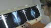 Removerán implantes de seno