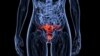 US Doctors Perform 4 Uterus Transplants from Live Donors