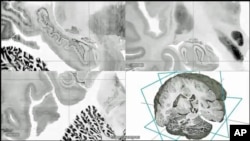 FILE - A highly-detailed image of the hippocampus region of the human brain.